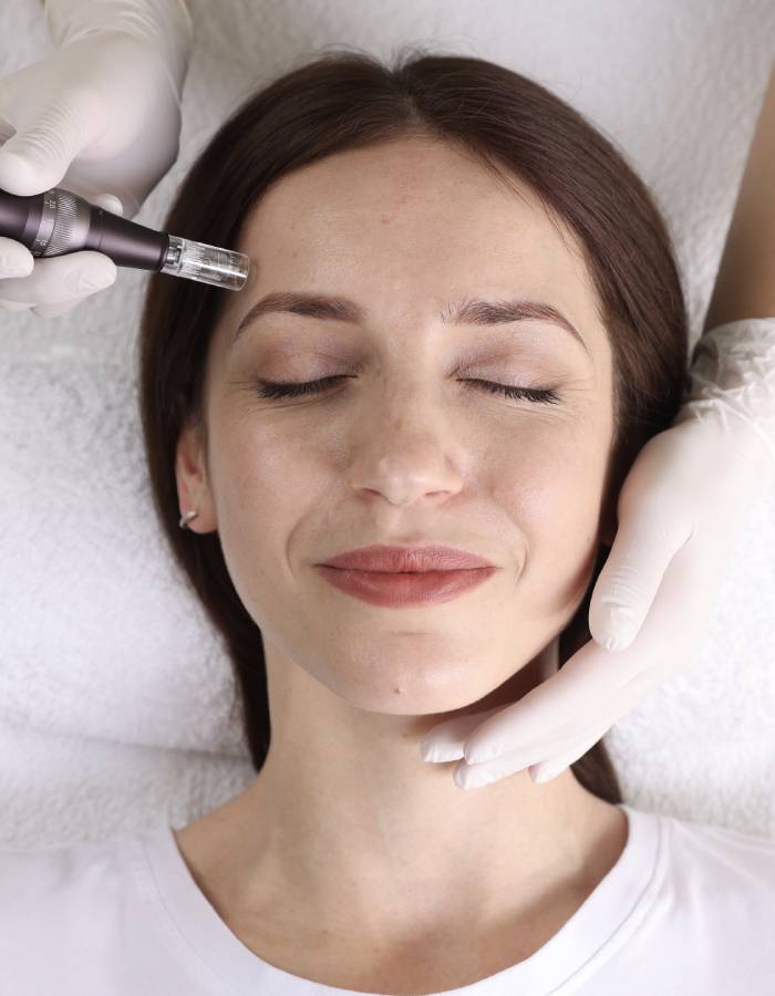 microneedling protocols